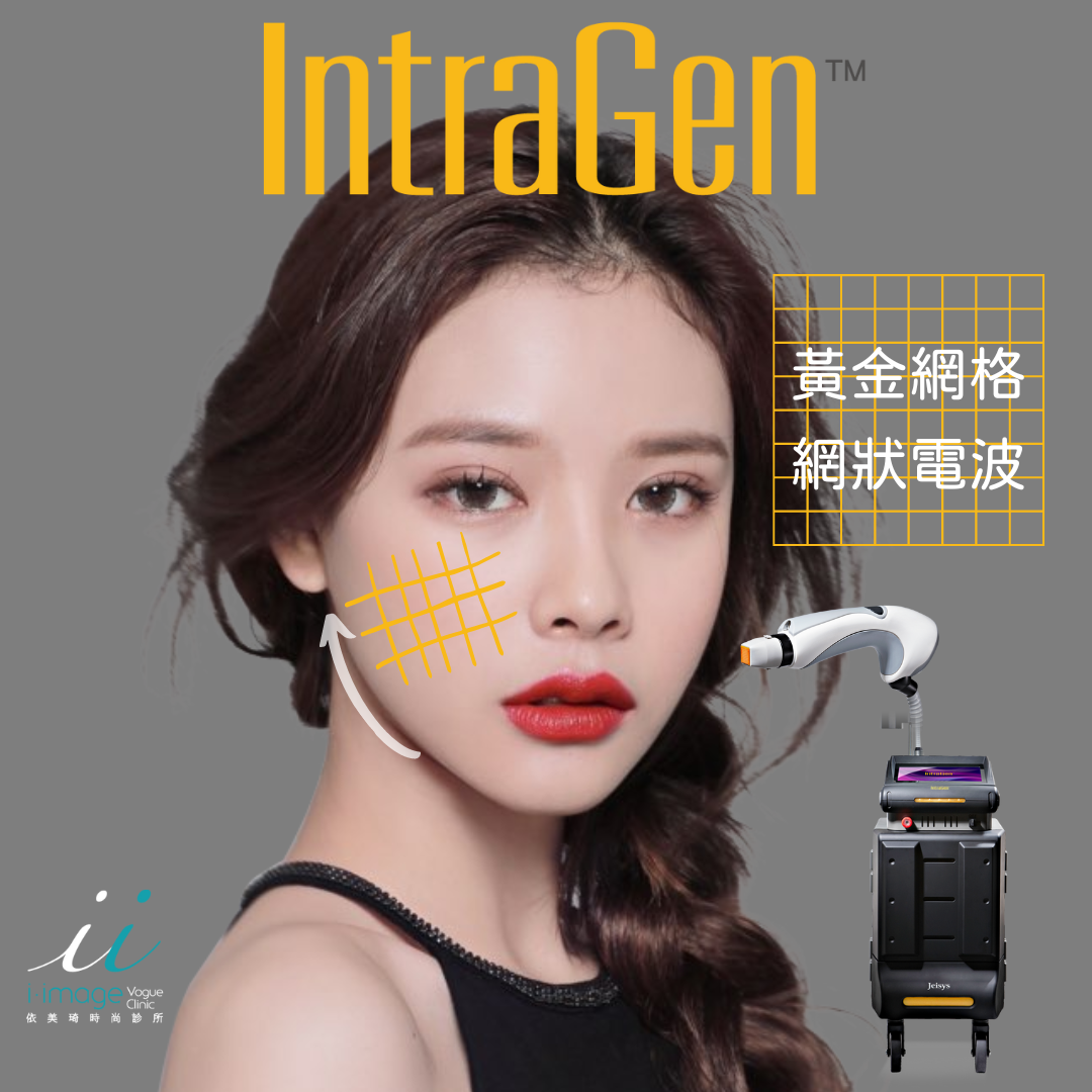 IG網格電波/網格電波