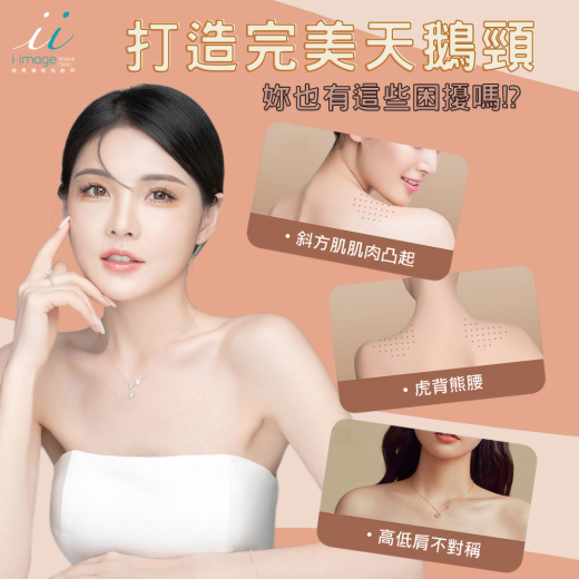 肉毒肩膀/美人肩/天鵝警
